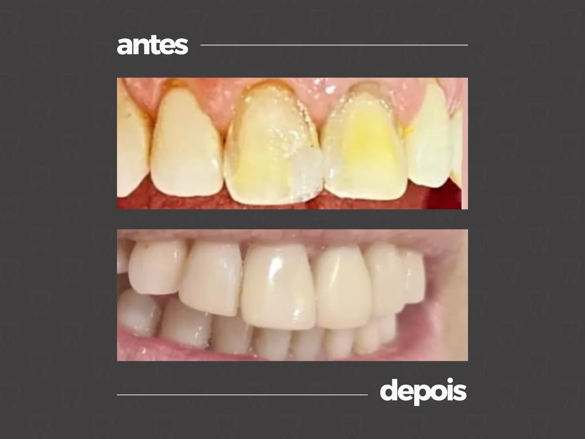 Comparativo clínico antes e depois, caso 10